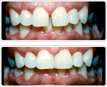 before after photos